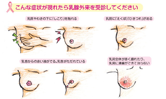 当院の乳がんの診断 乳腺外来に行ったらどんなことをするの 胸部 乳腺外科 診療の最前線 高松赤十字病院 日本赤十字社 香川県