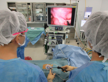 単孔式腹腔鏡下虫垂切除術