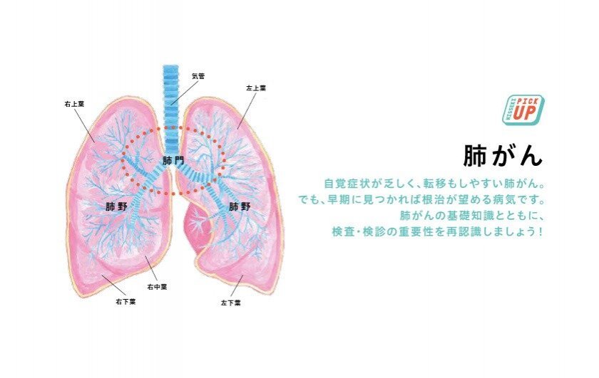 肺がん