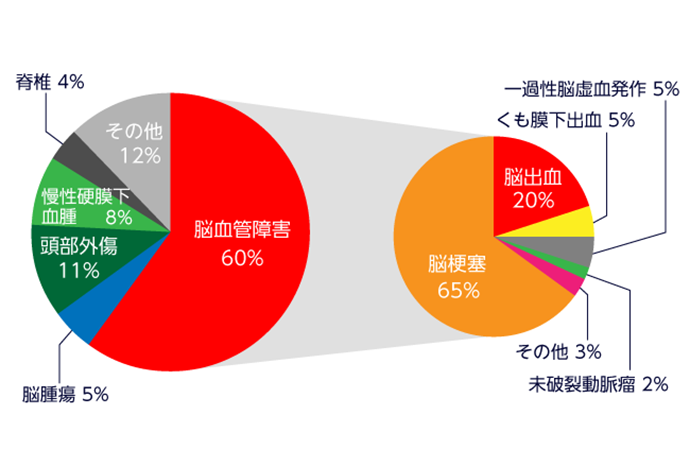 図2 2015年 全入院患者の疾患内訳、および、脳血管障害における疾患内訳