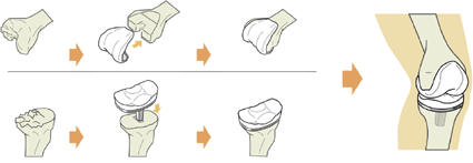 手術について