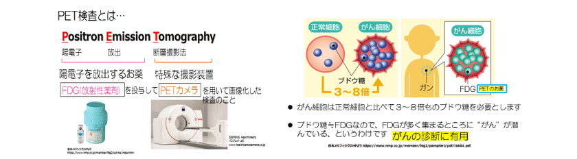 PET検査とは